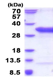 SDS-PAGE - Recombinant Human TSR2 protein (His tag N-Terminus) (AB183259)