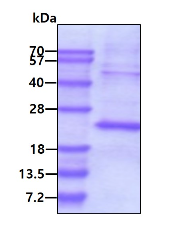 SDS-PAGE - Recombinant Human TSSC3 protein (His tag N-Terminus) (AB95505)