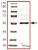 SDS-PAGE - Recombinant Human TSSK-3 protein (AB125619)