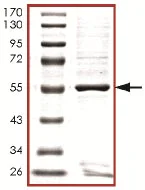 SDS-PAGE - Recombinant Human TSSK-3 protein (AB125619)