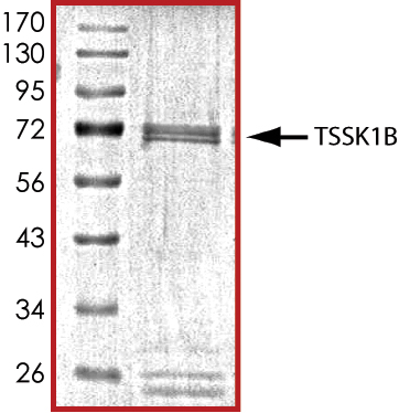 Recombinant human TSSK1 protein