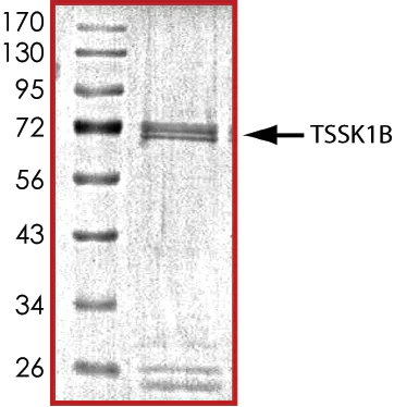 SDS-PAGE - Recombinant human TSSK1 protein (AB101710)