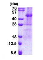 SDS-PAGE - Recombinant Human TSSK2 protein (denatured) (His tag N-Terminus) (AB171601)