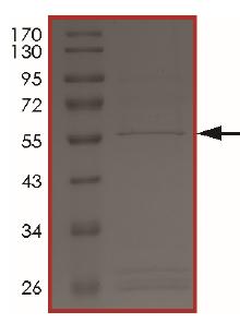 SDS-PAGE - Recombinant Human TSSK6 protein (AB204149), expandable thumbnail