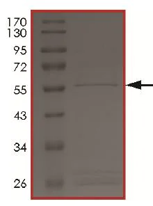 SDS-PAGE - Recombinant Human TSSK6 protein (AB204149)