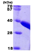 SDS-PAGE - Recombinant Human TST protein (AB89356)