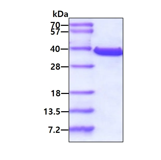 SDS-PAGE - Recombinant Human TST protein (His tag N-Terminus) (AB89356)