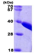 SDS-PAGE - Recombinant Human TST protein (His tag N-Terminus) (AB89356)