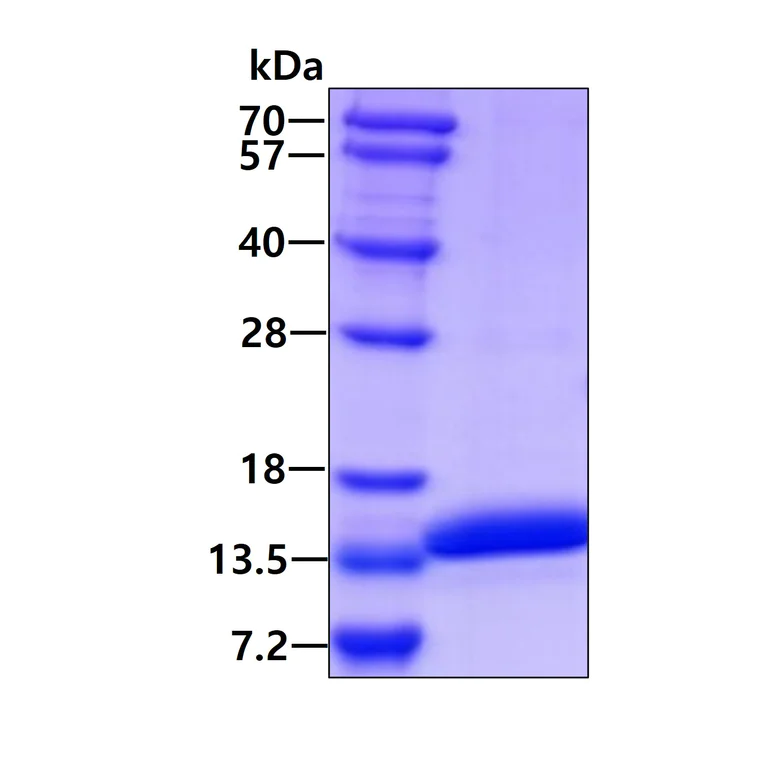 SDS-PAGE - Recombinant Human TSTD1 protein (AB104819)