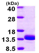 SDS-PAGE - Recombinant Human TSTD1 protein (AB104819)