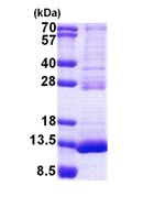 SDS-PAGE - Recombinant Human TSTD3 protein (AB167916), expandable thumbnail