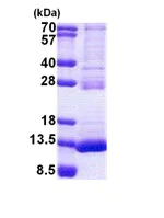 SDS-PAGE - Recombinant Human TSTD3 protein (AB167916)