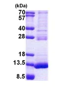 SDS-PAGE - Recombinant Human TSTD3 protein (His tag N-Terminus) (AB167916)