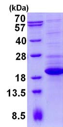 SDS-PAGE - Recombinant Human TTC32 protein (His tag N-Terminus) (AB134614)