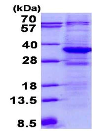 SDS-PAGE - Recombinant Human TTC33 protein (His tag N-Terminus) (AB134550)