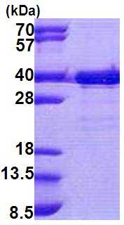 SDS-PAGE - Recombinant Human TTC35 protein (AB167894)