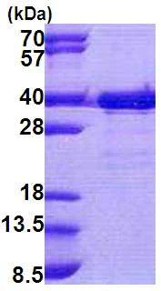 SDS-PAGE - Recombinant Human TTC35 protein (His tag N-Terminus) (AB167894)