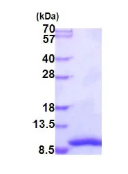 SDS-PAGE - Recombinant Human TTDA protein (His tag N-Terminus) (AB187616)