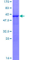 SDS-PAGE - Recombinant Human TTPA/TPP1 protein (AB159756)