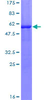 SDS-PAGE - Recombinant Human TTPA/TPP1 protein (AB159756)