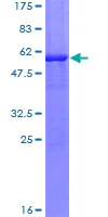 SDS-PAGE - Recombinant Human TTPA/TPP1 protein (GST tag N-Terminus) (AB159756)