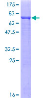 SDS-PAGE - Recombinant Human TUBA1C protein (AB164660), expandable thumbnail