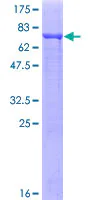 SDS-PAGE - Recombinant Human TUBA1C protein (AB164660)