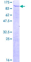 SDS-PAGE - Recombinant Human Tubby like protein 4 (AB163458), expandable thumbnail