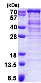 SDS-PAGE - Recombinant Human TUG protein (His tag N-Terminus) (AB167886)