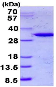 SDS-PAGE - Recombinant Human TULP1 protein (His tag N-Terminus) (AB131704)