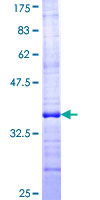 SDS-PAGE - Recombinant Human TUSC2/FUS1 protein (AB161417)