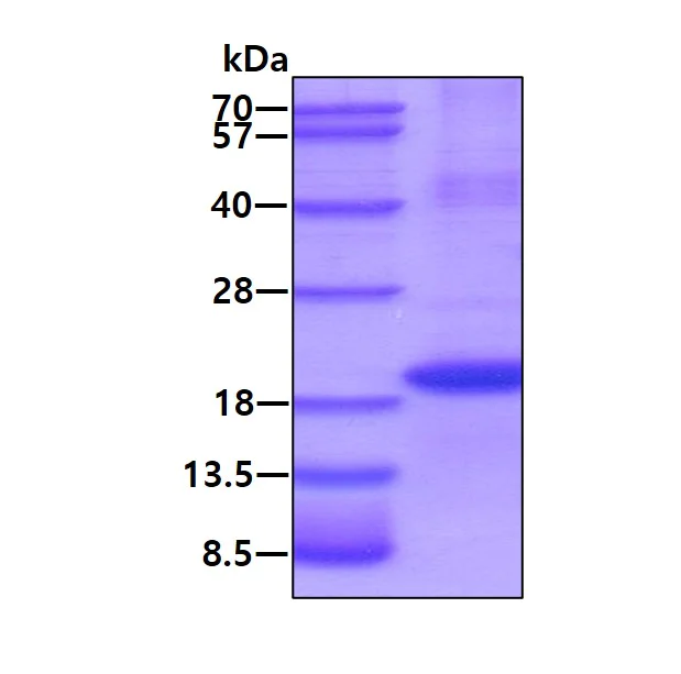 SDS-PAGE - Recombinant Human TUSC2/FUS1 protein (denatured) (His tag N-Terminus) (AB171606)