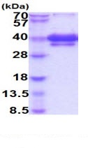 SDS-PAGE - Recombinant Human TWEAKR/FN14 protein (Fc Chimera His Tag) (AB223000), expandable thumbnail