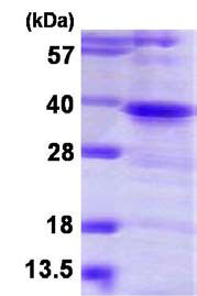 SDS-PAGE - Recombinant Human TWF1/Twinfilin-1 protein (AB116148), expandable thumbnail