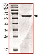 SDS-PAGE - Recombinant Human TWF1/Twinfilin-1 protein (AB131676)