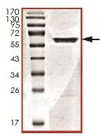 SDS-PAGE - Recombinant Human TWF1/Twinfilin-1 protein (AB131676)