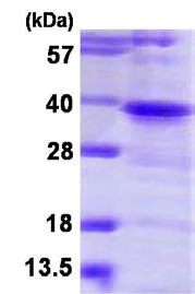 SDS-PAGE - Recombinant Human TWF1/Twinfilin-1 protein (His tag N-Terminus) (AB116148)