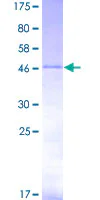 SDS-PAGE - Recombinant Human Twist protein (GST tag N-Terminus) (AB132349)