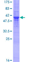 SDS-PAGE - Recombinant Human TXNDC/TMX protein (AB164331), expandable thumbnail