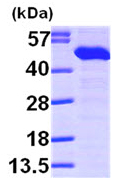 Western blot - Recombinant Human TXNDC4 protein (His tag N-Terminus) (AB99218)