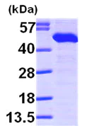 Western blot - Recombinant Human TXNDC4 protein (His tag N-Terminus) (AB99218)