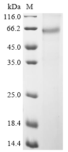 SDS-PAGE - Recombinant Human TXNIP protein (AB289756), expandable thumbnail