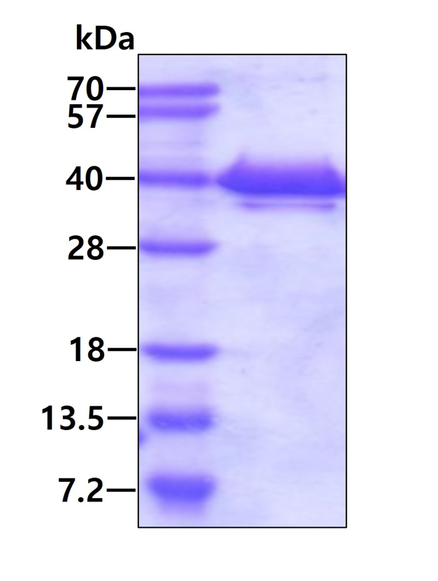 SDS-PAGE - Recombinant Human TXNL1 protein (AB103050), expandable thumbnail