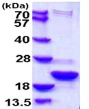 SDS-PAGE - Recombinant Human TXNL4B protein (His tag N-Terminus) (AB108121)