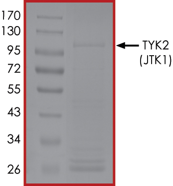 Recombinant human TYK2 protein