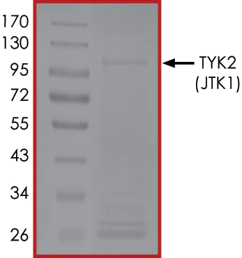SDS-PAGE - Recombinant human TYK2 protein (AB125539)