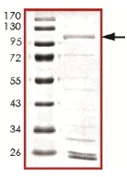 SDS-PAGE - Recombinant human TYK2 protein (AB125539)