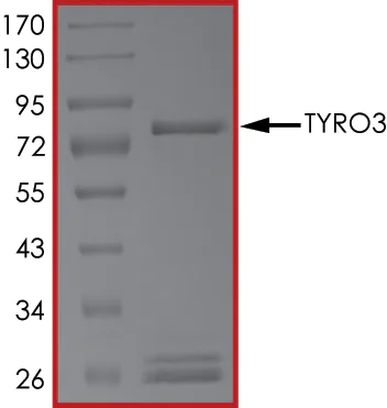 SDS-PAGE - Recombinant human TYRO3 protein (AB64304)