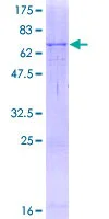 SDS-PAGE - Recombinant Human Tyrosinase protein (GST tag N-Terminus) (AB152776)