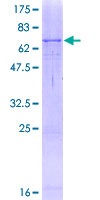 SDS-PAGE - Recombinant Human Tyrosinase protein (Tagged) (AB152776)